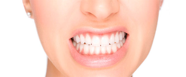 Bruxismo Implantes Dentales