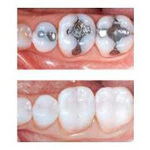 Empastes-Dentales1