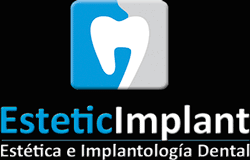 Implantes Dentales