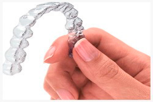 Invisalign