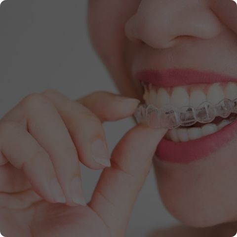 Ortodoncia Brackets
