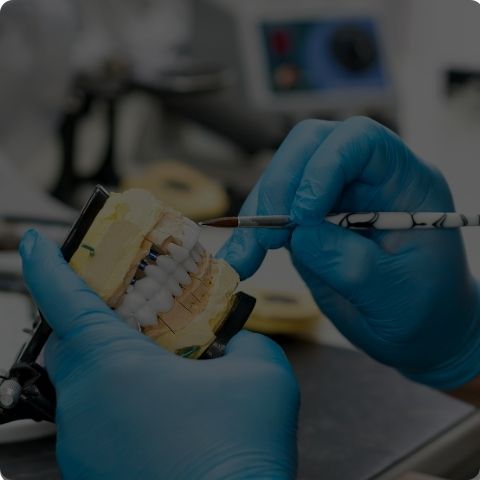 Implantes Dentales Resinas