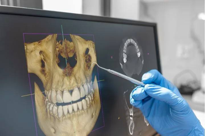 Tomografia Dental