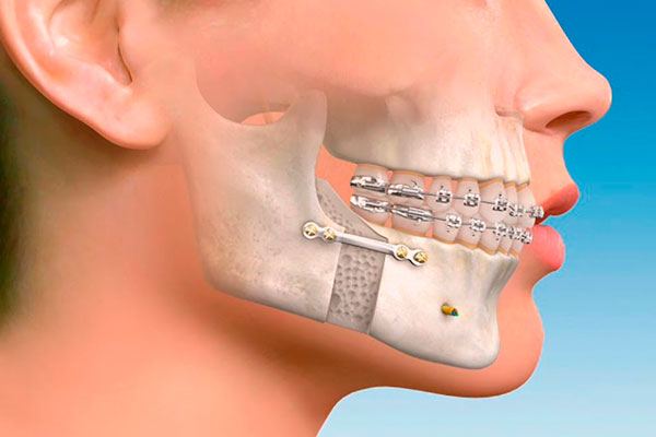 Cirujano Maxilofacial