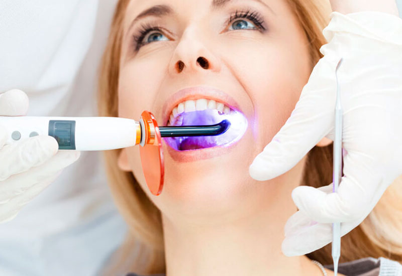 Blanqueamiento Dental