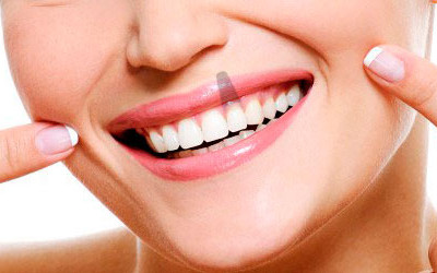 Preguntas Frecuentes sobre Implantes Dentales