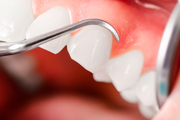 Periodoncista
